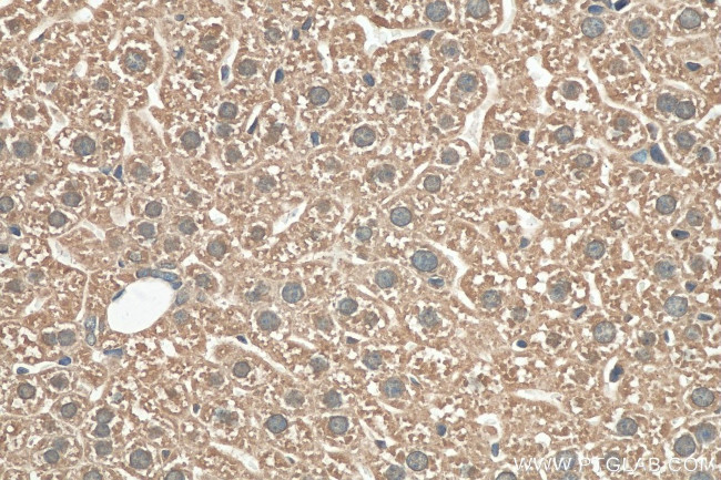 GPR179 Antibody in Immunohistochemistry (Paraffin) (IHC (P))