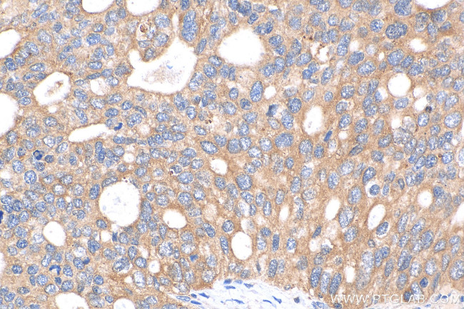 NETO1 Antibody in Immunohistochemistry (Paraffin) (IHC (P))