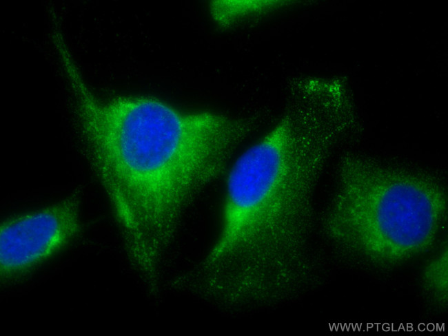 DOCK5 Antibody in Immunocytochemistry (ICC/IF)