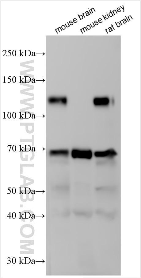 UNC5D Antibody in Western Blot (WB)