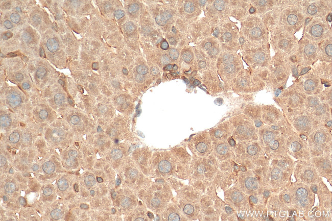 MYD88 Antibody in Immunohistochemistry (Paraffin) (IHC (P))