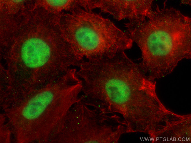 NCOR2 Antibody in Immunocytochemistry (ICC/IF)