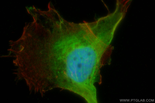 PER2 Antibody in Immunocytochemistry (ICC/IF)