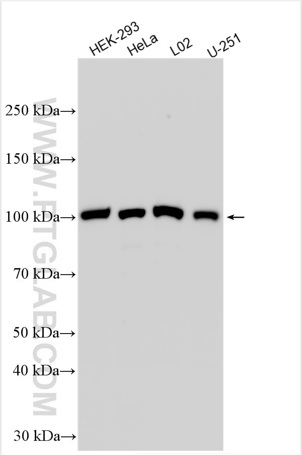 TSR1 Antibody in Western Blot (WB)