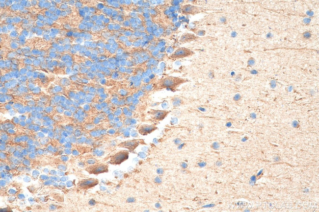 TrkB Antibody in Immunohistochemistry (Paraffin) (IHC (P))
