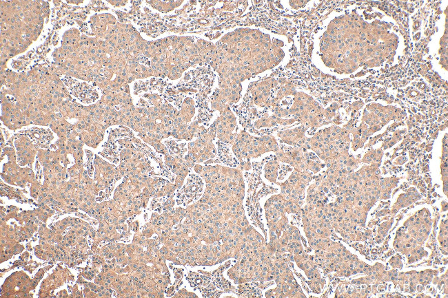 TRPV3 Antibody in Immunohistochemistry (Paraffin) (IHC (P))