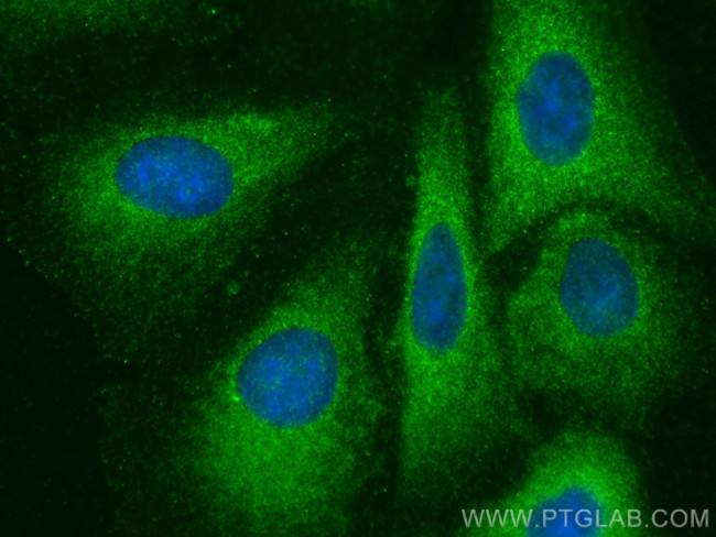 IREB2 Antibody in Immunocytochemistry (ICC/IF)
