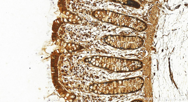 HOXA9 Antibody in Immunohistochemistry (Paraffin) (IHC (P))