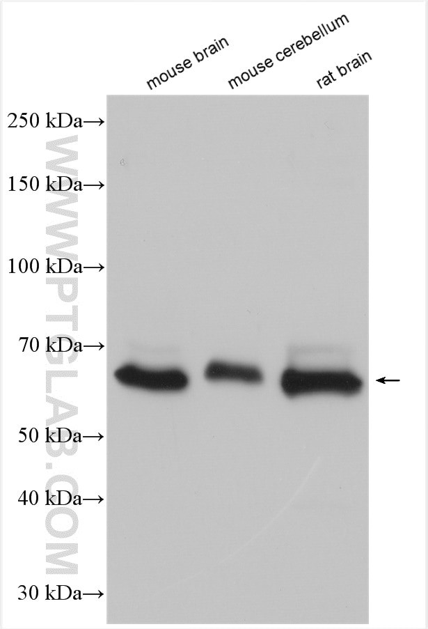GPR37 Antibody in Western Blot (WB)
