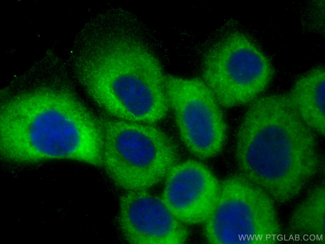 PLA2G4E Antibody in Immunocytochemistry (ICC/IF)