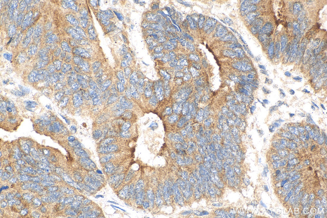 Fibulin 5 Antibody in Immunohistochemistry (Paraffin) (IHC (P))