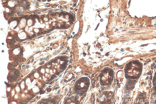 MYO5B Antibody in Immunohistochemistry (Paraffin) (IHC (P))