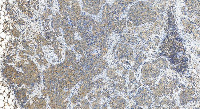 WDR73 Antibody in Immunohistochemistry (Paraffin) (IHC (P))