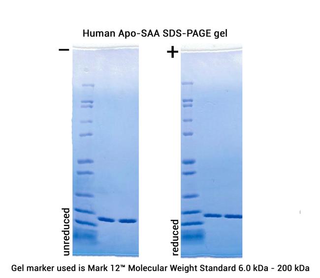 Human Apo-SAA Protein in Bioactivity (Bioactivity)