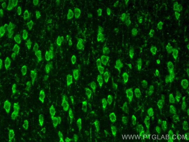IL3RA/CD123 Antibody in Immunohistochemistry (PFA fixed) (IHC (PFA))