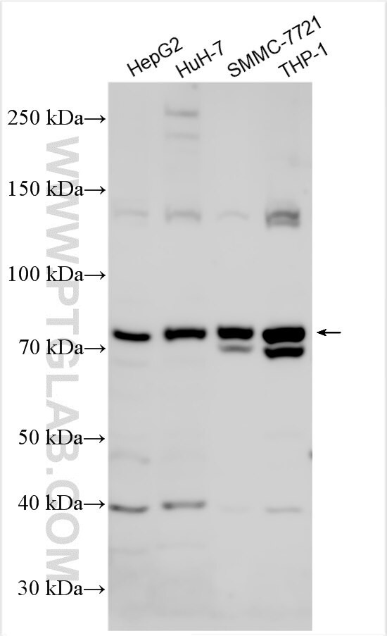 ZNF643 Antibody in Western Blot (WB)