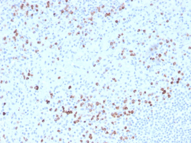 Granzyme B (NK/T-Cell Lymphoma Marker) Antibody in Immunohistochemistry (Paraffin) (IHC (P))