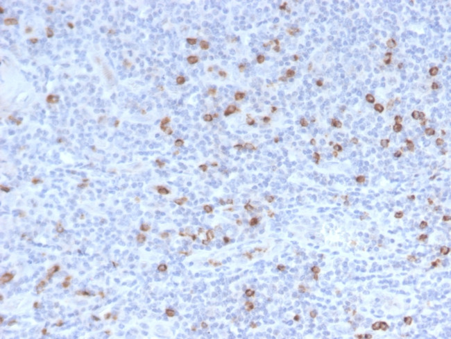 Granzyme B Antibody in Immunohistochemistry (Paraffin) (IHC (P))