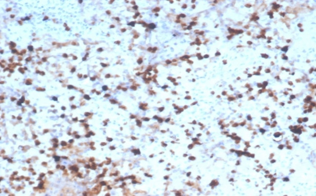 Granzyme B (NK/T-Cell Lymphoma Marker) Antibody in Immunohistochemistry (Paraffin) (IHC (P))