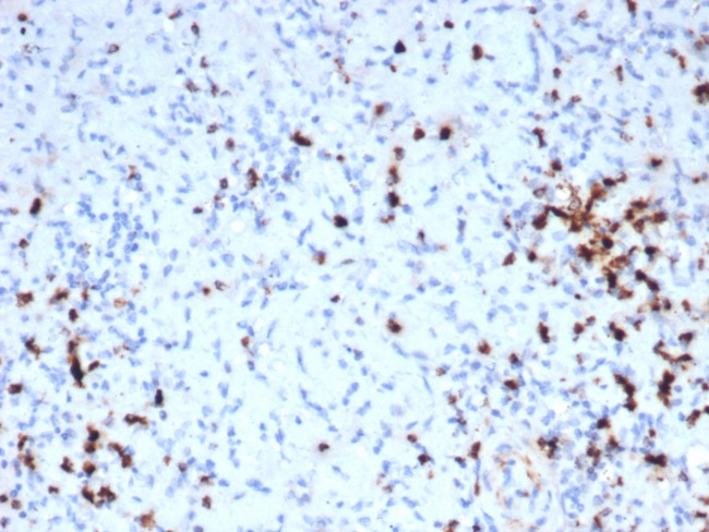 Granzyme B (NK/T-Cell Lymphoma Marker) Antibody in Immunohistochemistry (Paraffin) (IHC (P))