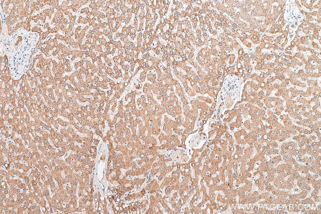 BCKDHA Antibody in Immunohistochemistry (Paraffin) (IHC (P))