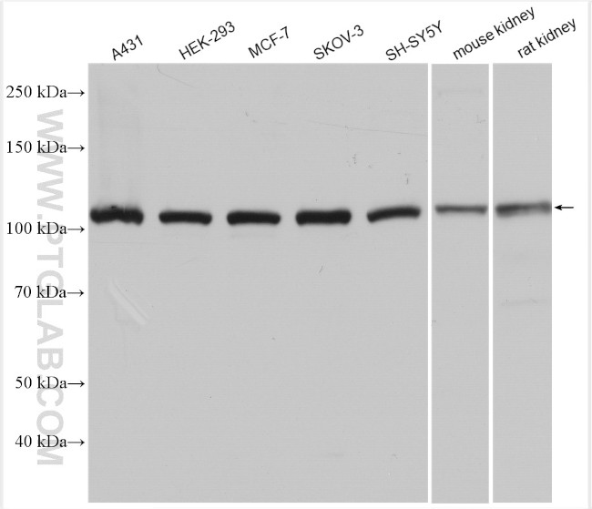 AP2A1 Antibody in Western Blot (WB)