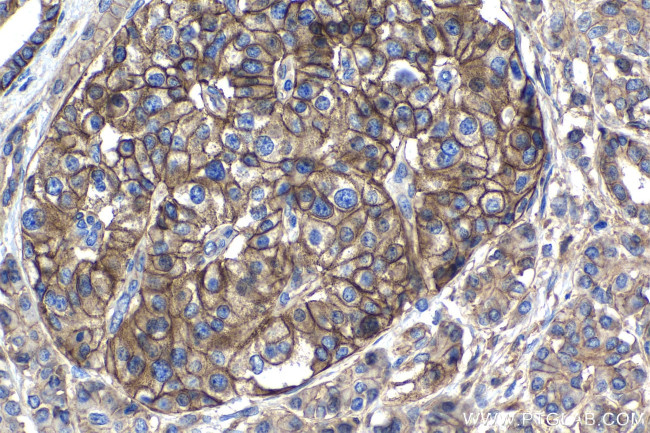 ATP2B1 Antibody in Immunohistochemistry (Paraffin) (IHC (P))