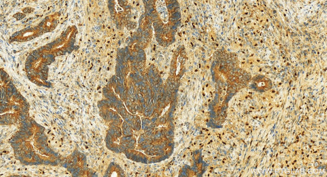 SMIM24 Antibody in Immunohistochemistry (Paraffin) (IHC (P))