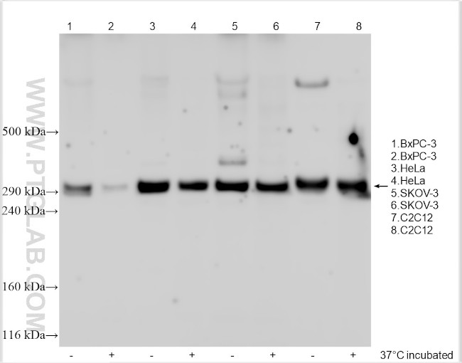 SCNN1G Antibody in Western Blot (WB)