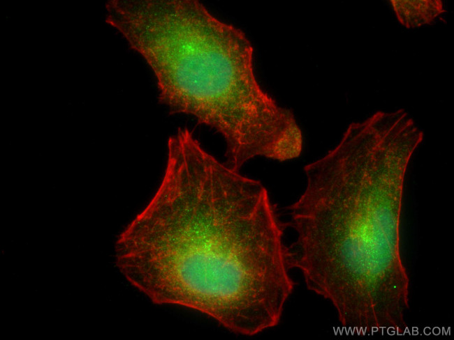 BAHCC1 Antibody in Immunocytochemistry (ICC/IF)