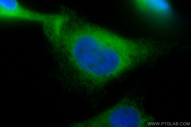 GPSN2 Antibody in Immunocytochemistry (ICC/IF)