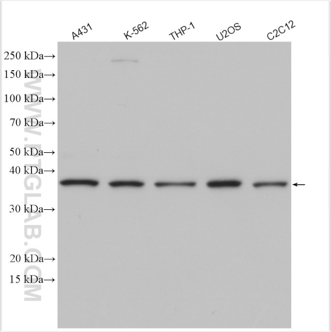 CDK10 Antibody in Western Blot (WB)