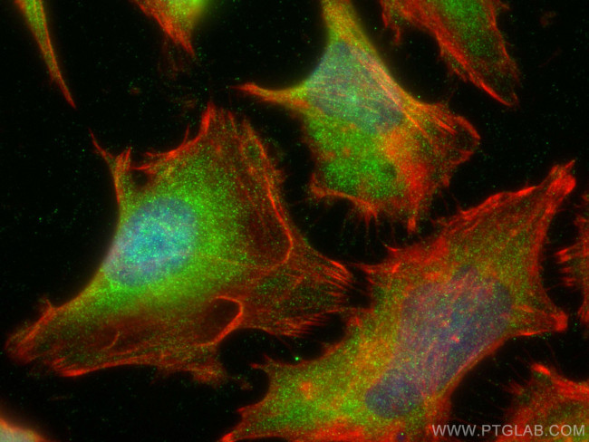 PPP1CC Antibody in Immunocytochemistry (ICC/IF)