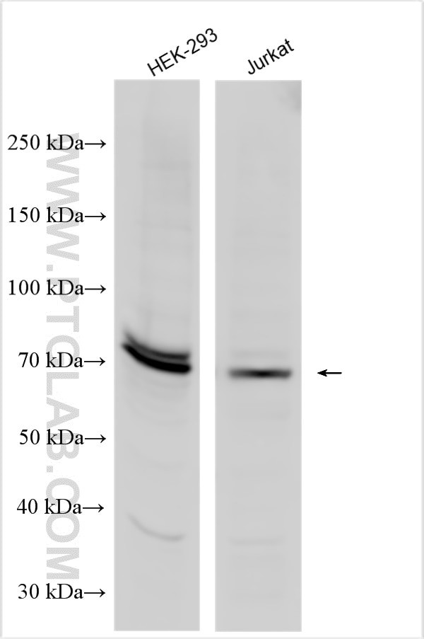 FOXC1 Antibody in Western Blot (WB)