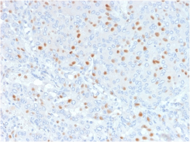 Annexin A1/ (Hairy Cell Leukemia Marker) Antibody in Immunohistochemistry (Paraffin) (IHC (P))