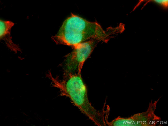POGZ Antibody in Immunocytochemistry (ICC/IF)