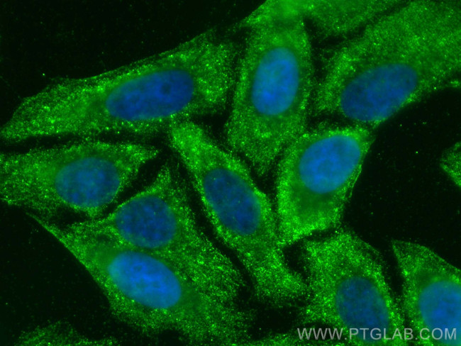 Nlrp3 Antibody in Immunocytochemistry (ICC/IF)
