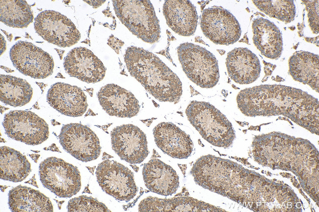 TTC21B Antibody in Immunohistochemistry (Paraffin) (IHC (P))