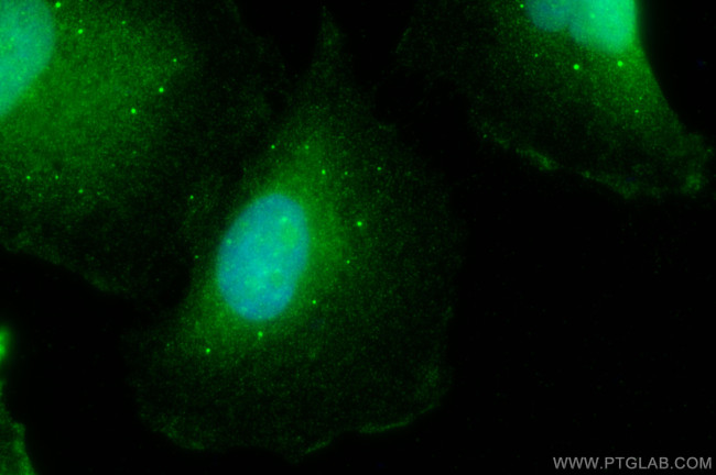 NFATC1 Antibody in Immunocytochemistry (ICC/IF)
