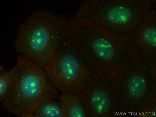 KNOP1 Antibody in Immunocytochemistry (ICC/IF)