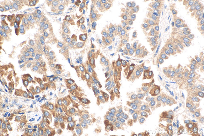 TGFBR1 Antibody in Immunohistochemistry (Paraffin) (IHC (P))