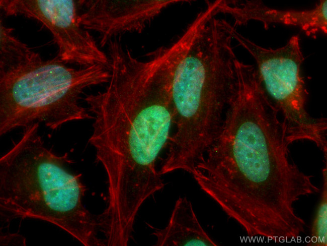 RIF1 Antibody in Immunocytochemistry (ICC/IF)
