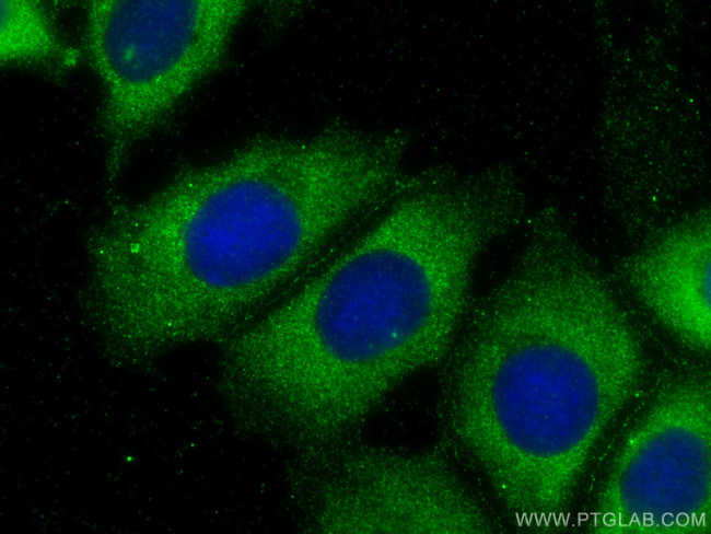 ST3GAL5 Antibody in Immunocytochemistry (ICC/IF)