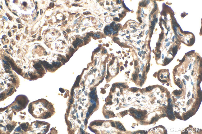 PARP14 Antibody in Immunohistochemistry (Paraffin) (IHC (P))