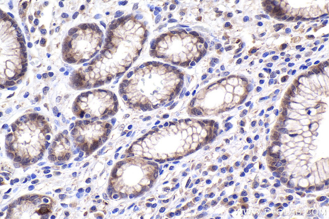 SMAD3 Antibody in Immunohistochemistry (Paraffin) (IHC (P))