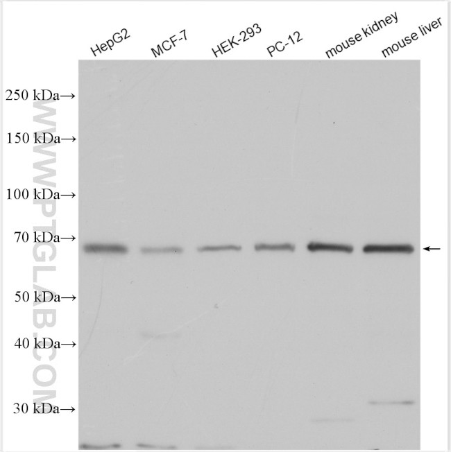 NOX3 Antibody in Western Blot (WB)