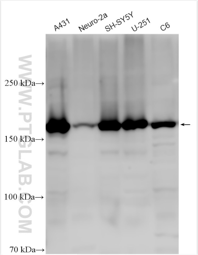 KIAA1797 Antibody in Western Blot (WB)