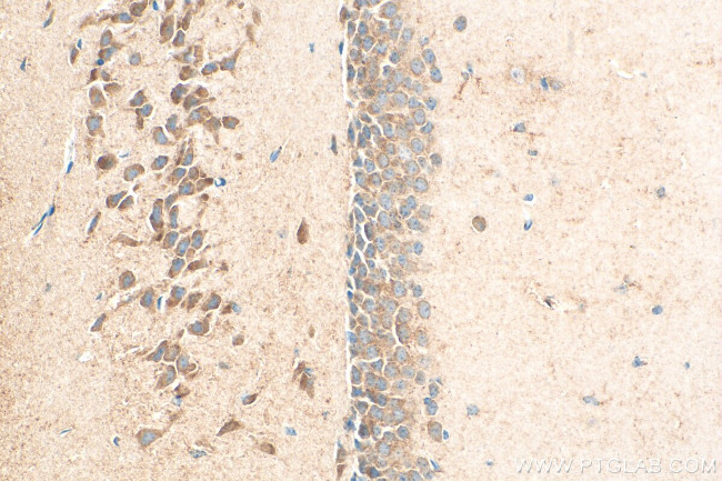 LPHN1 Antibody in Immunohistochemistry (Paraffin) (IHC (P))