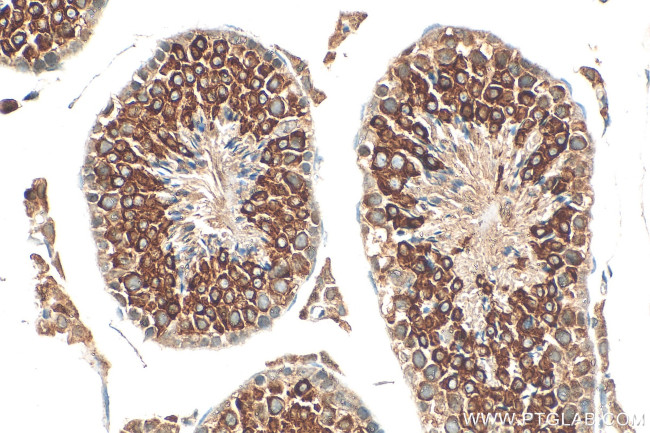 LRRC50 Antibody in Immunohistochemistry (Paraffin) (IHC (P))