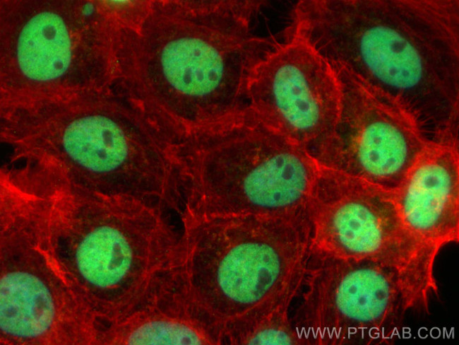 IPMK Antibody in Immunocytochemistry (ICC/IF)
